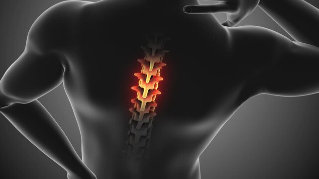 Spinal Pain Neck Back Anatomy Medical Concept