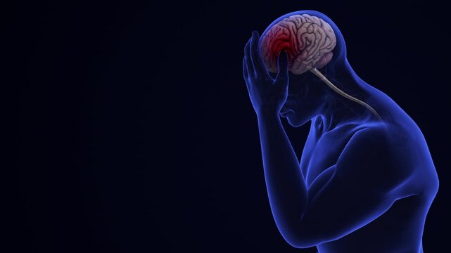 Brain Hemorrhage Pain Human Neurology Medical Concept