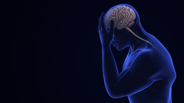 Brain Hemorrhage Pain Human Neurology Medical Concept