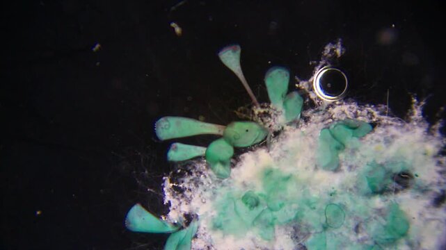 Stentor ciliates attached to white detritus mass under 40x darkfield microscopy. 4K scientific microscopy footage.