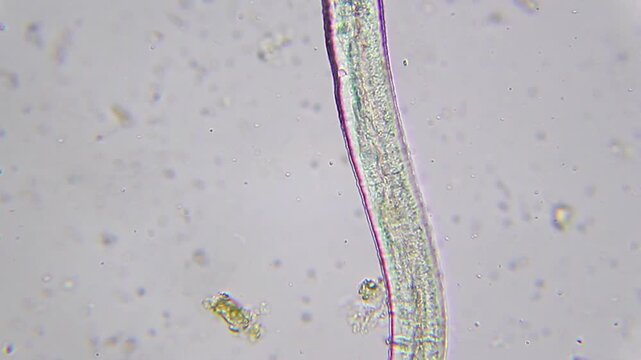 Nematode with visible granular internal structure among detritus under 400x brightfield microscopy. 4K scientific microscopy footage.