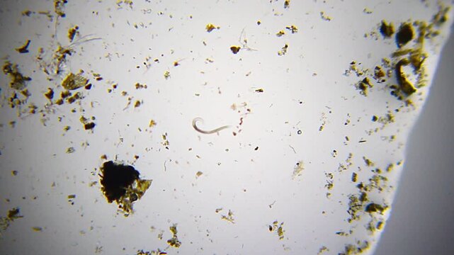 Active nematode forming loops among detritus under 40x brightfield microscopy. 4K scientific microscopy footage.