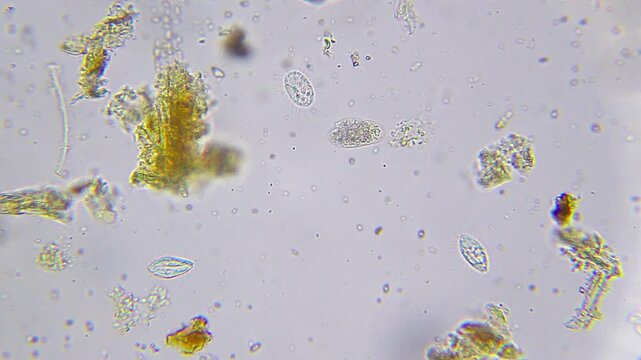 Ciliates resting among detritus particles under 400x brightfield microscopy. 4K scientific microscopy footage.