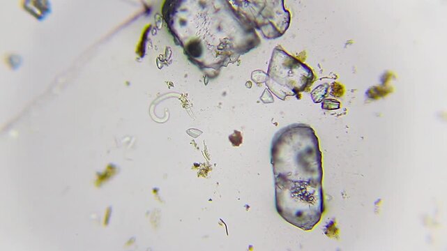 Nematode moving among salt crystals and detritus under 100x brightfield microscopy. 4K scientific microscopy footage.