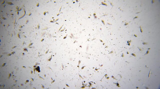 Rotifers in panoramic view with single nematode under 40x brightfield microscopy. 4K scientific microscopy footage.