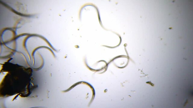 Active nematodes with rotifers in fluid environment under 40x brightfield microscopy. 4K scientific microscopy footage.