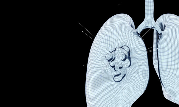 Human lungs and viral infections, pneumonia, and cancer gene mutations