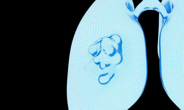 Human lungs and viral infections, pneumonia, and cancer gene mutations