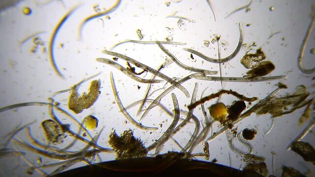 Nematodes in alcohol solution among detritus particles under 40x brightfield microscopy. 4K scientific microscopy footage.