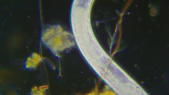 Nematode with visible internal eggs and organs near yellow detritus under 400x darkfield microscopy. 4K scientific microscopy footage.