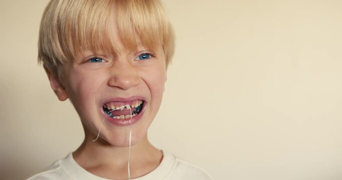 A close-up of a happy fair-haired boy who is about to lose his front baby tooth. He is exited to pull it out with dental floss
