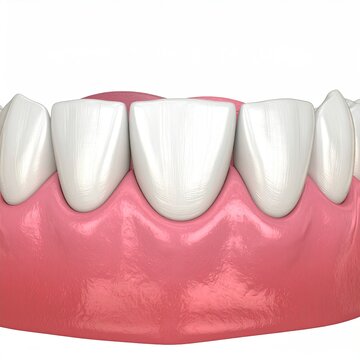 Human teeth and gum illustration showing inflammation with gingivitis dental health concept in bright white and pink tones