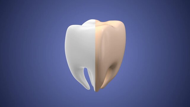 Medical animation of the healthy and yellow tooth
