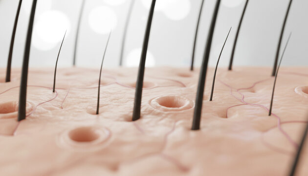 顕微鏡で見た薄毛の頭皮の3DCGイラスト  毛穴が開いたイメージ 