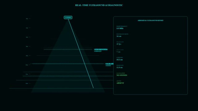 Real-time medical imaging data is processed through advanced AI Diagnostic Algorithms, generating instant abdominal ultrasound reports with automated findings and measurements.