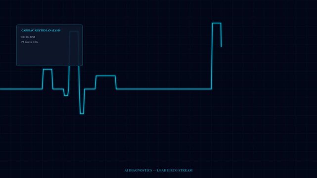Real-time cardiac rhythm analysis using sophisticated AI Diagnostic Algorithms displayed on a digital monitor, reflecting advancements in medical technology and patient care.