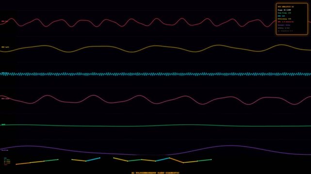 Monitoring patient health through intricate waveform patterns, advanced AI Diagnostic Algorithms provide real-time polysomnography data for comprehensive sleep diagnostics.
