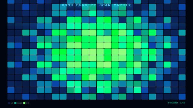 Visualizing biometric data flow through a dynamic bone density scan matrix, providing critical medical diagnostic analysis with color-coded results on a sophisticated digital display.