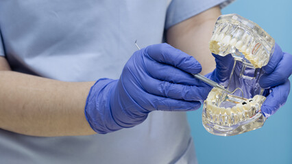 Dentist hands in blue gloves holding transparent dental typodont model and pointing at tooth decay with an explorer.