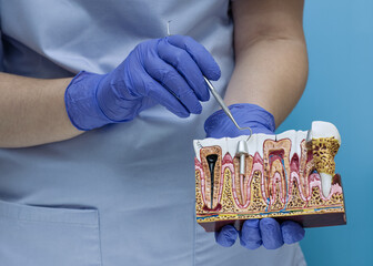 Dentist showing root canal treatment and dental anatomy on a cross-section gum model with professional probe.