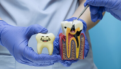Dentist in gloves using a probe on a decayed tooth model next to a happy healthy tooth toy.