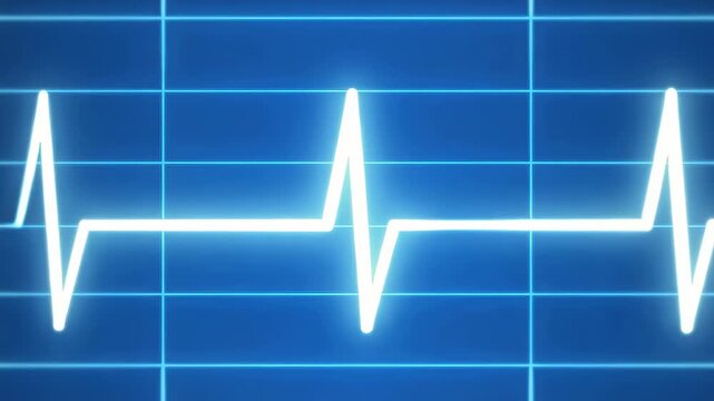This shows a heart rate on a medical monitor screen with a blue background. The is a close-up shot of the screen displaying a heart rate graph.