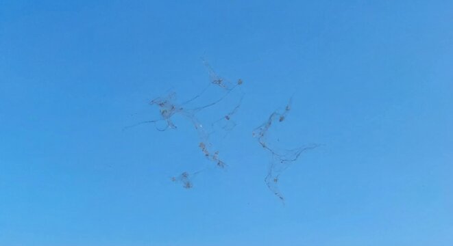 Vitreous floaters simulated against clear blue sky POV