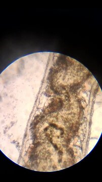 Microscopic view of Aulophorus freshwater worm with branchial fossa and internal organs.