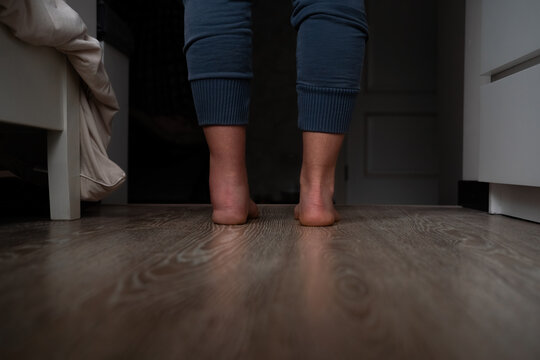 Back view of woman legs showing ankle injury and healthy leg comparison, traumatized female standing in the bedroom at home.