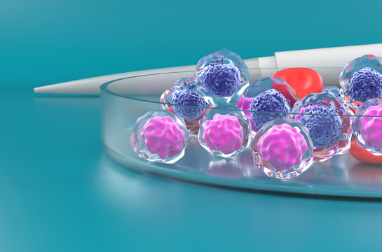 Acute myeloid leukemia (AML) - closeup view 3d illustration