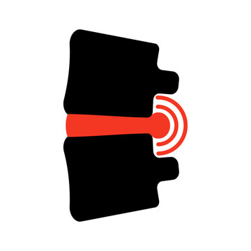 Spine with disc inflammation black icon. Human vertebrae showing injury, nerve pain. Orthopedic medical symbol backache, spinal problem, treatment, healthcare diagnostic clinic. Vector illustration