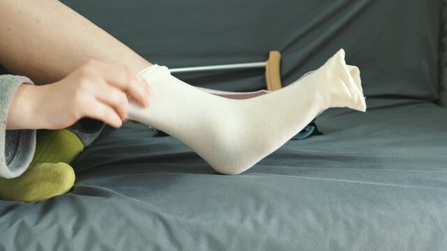 A person applies a beige compression stocking to their leg
