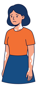 Cartoon illustration of a sad woman depicting vitiligo skin condition depicting depigmentation patches for health and awareness design