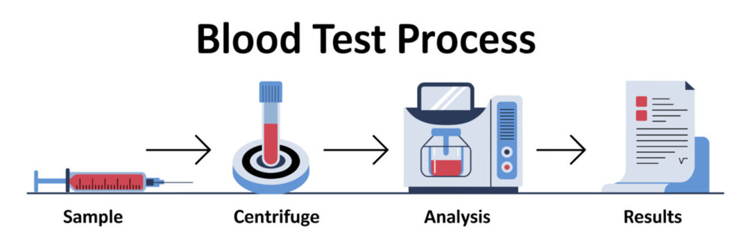 Blood Processing Lab Blood Process Infographic Images – Browse 1,195 Stock Photos, Vectors ...