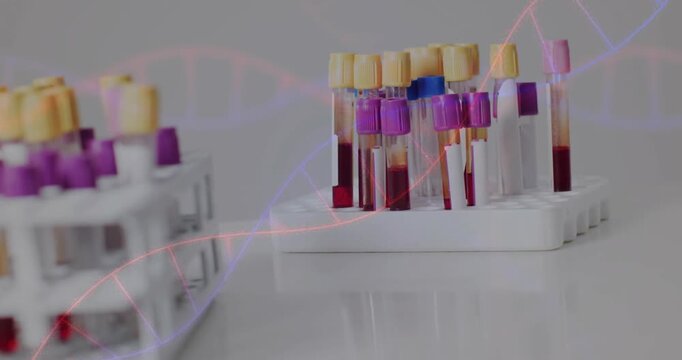 Right blood rack remaining while camera pushing and helix shifting bringing samples into lab focus