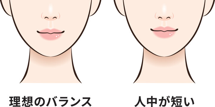 理想のバランスと人中短め　顔バランス比較図（クローズアップ）