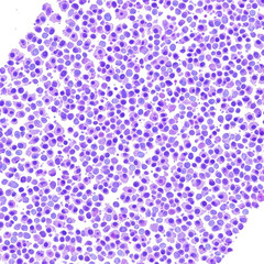 Obraz premium Microscopic view of stained biological tissue showing a dense population of purple cell nuclei isolated on transparent background