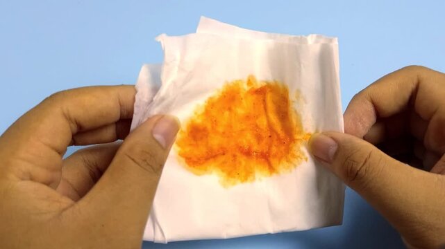Hand holding a white napkin stained with orange liquid, potentially indicating a positive tuberculosis test result and requiring medical attention