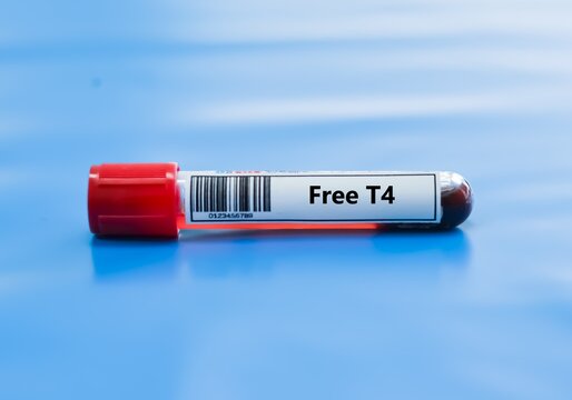 Blood sample tube for free T4 test analysis.
