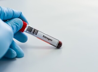 Blood sample tube for estrogen test analysis. © kitsawet