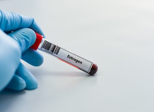 Blood sample tube for estrogen test analysis.