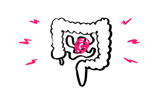 Intestine diseases sketch