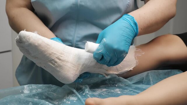Doctor reinforcing plaster cast on child leg adding extra bandage layer to secure immobilization orthopedic treatment process trauma care and injury recovery indoors.