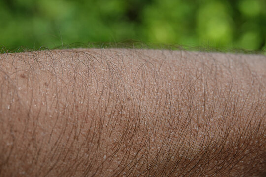 CLOSE UP, DOF: Human skin with fine hairs on the arms and visible texture against a soft green blurred background. Pores, follicles and incredible details of the natural surface of a human forearm.