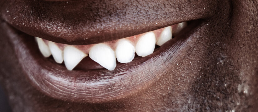 Cultural dental modification in Angola