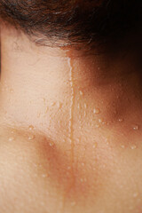 Fototapeta premium Sweat beads on skin after exercise in hot weather conditions,