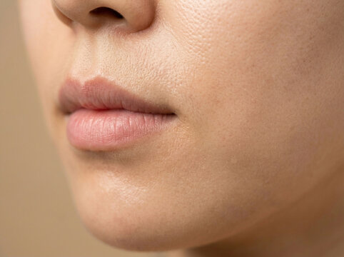 피부 비포 애프터 AI 피부개선 Skin Before After AI Skin Improvement