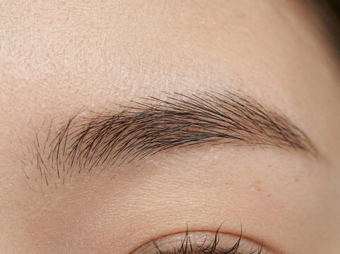 피부 비포 애프터 AI 피부개선 Skin Before After AI Skin Improvement