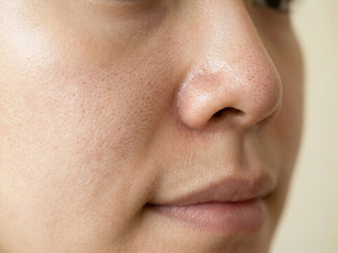 피부 비포 애프터 AI 피부개선 Skin Before After AI Skin Improvement