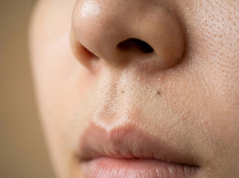 피부 비포 애프터 AI 피부개선 Skin Before After AI Skin Improvement